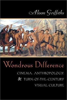 Wondrous Difference