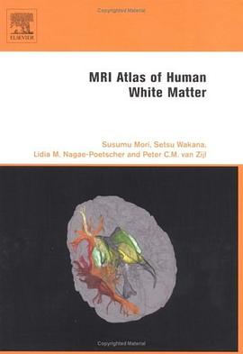 MRI Atlas of Human White Matter (精装)
