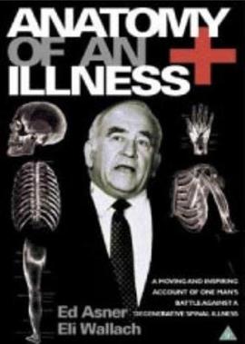 Anatomy of an Illness