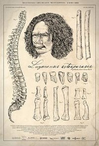 吕宋人骨质疏松记