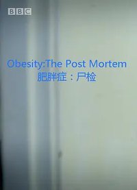 Obesity: The Post Mortem