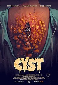 CYST