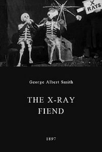 X-Rays