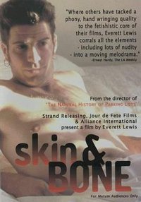 Skin and Bone
