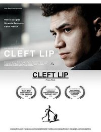 Cleft Lip